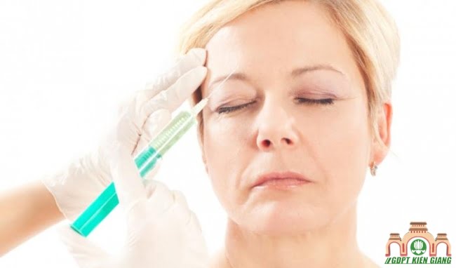 tiem botox giup giam nep nhan len toi 4 thang11432525523