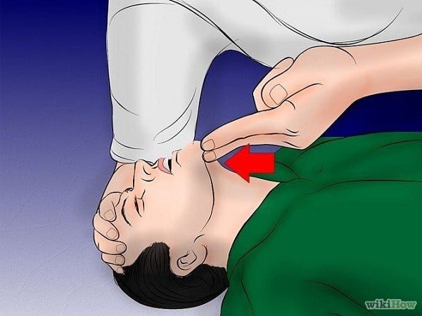 Tranh vẽ: 7 kỹ năng cứu người ai cũng cần biết 2