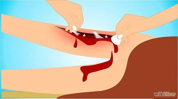 Tranh vẽ: 7 kỹ năng cứu người ai cũng cần biết 19