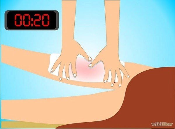 Tranh vẽ: 7 kỹ năng cứu người ai cũng cần biết 20